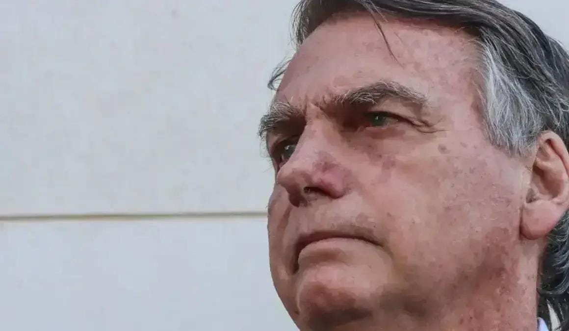 Defesa prévia Bolsonaro STF