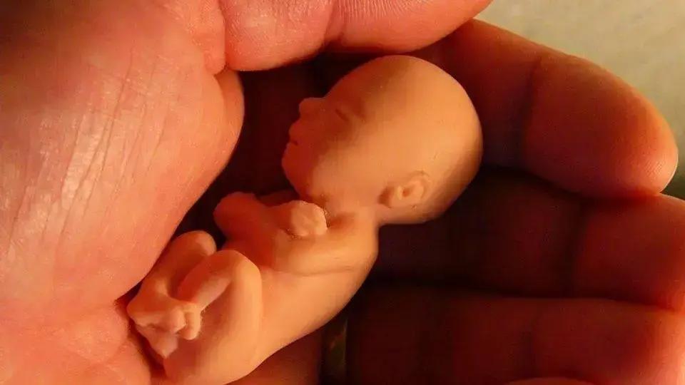 PL Antiaborto por Estupro
