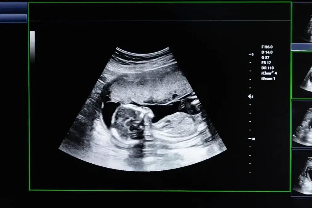 Predisposição para gerar filhos
