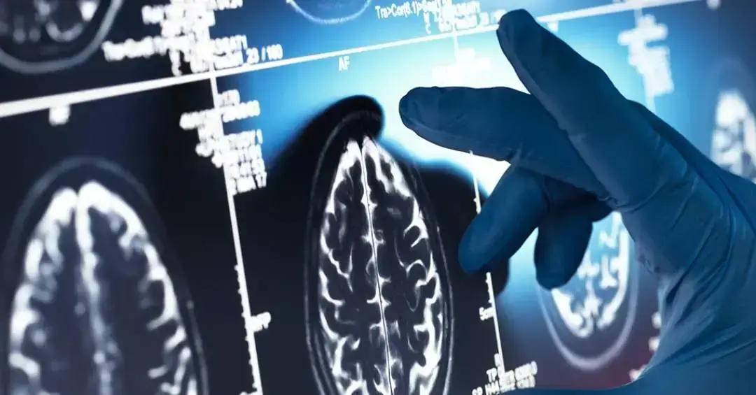 Demência em camundongos