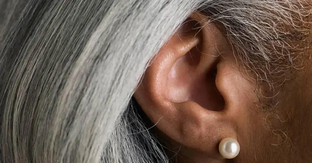 Embranquecimento dos fios