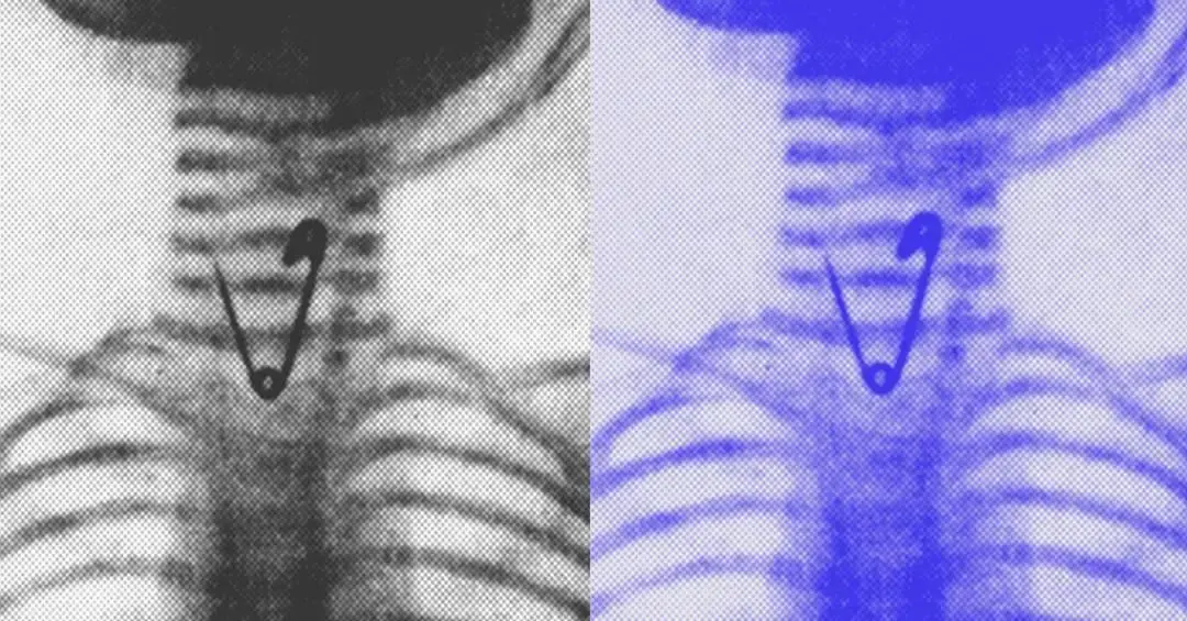 Localizar objetos metálicos no corpo